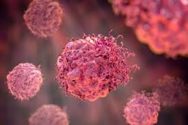 Scientists Develop Promising New Approaches for Ovarian Cancer Treatment